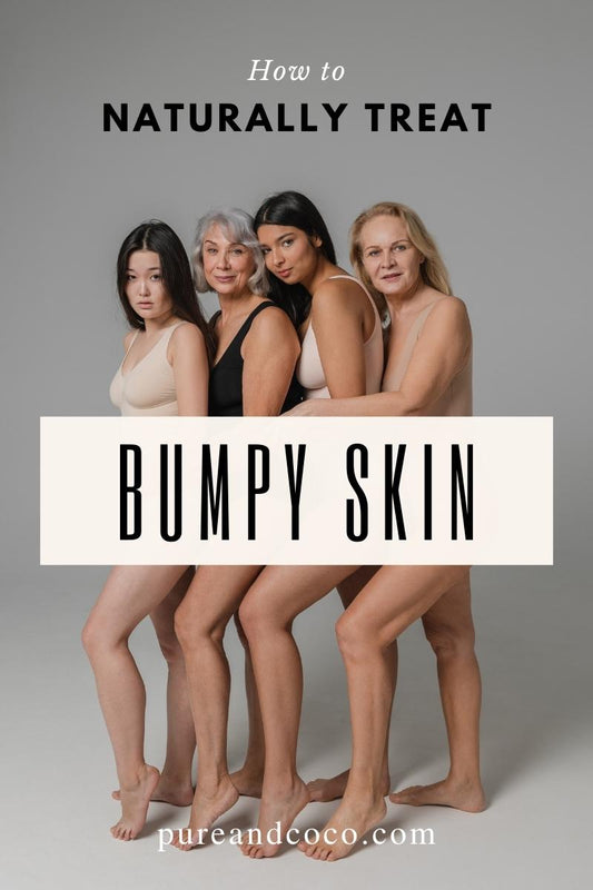 How to Naturally Treat Keratosis Pilaris (aka Chicken Skin)