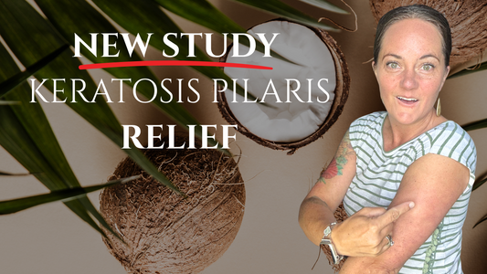 Woman pointing to keratosis pilaris bumps on arm next to headline ‘New Study – Keratosis Pilaris Relief’ with coconuts in background. Pure & Coco natural coconut oil polish shown as KP treatment for bumpy arms, chicken skin, and dry sensitive skin.