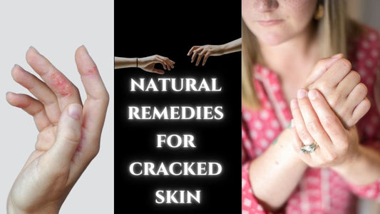 7 Hydrating Hand Care Tips for Dry Skin [video]