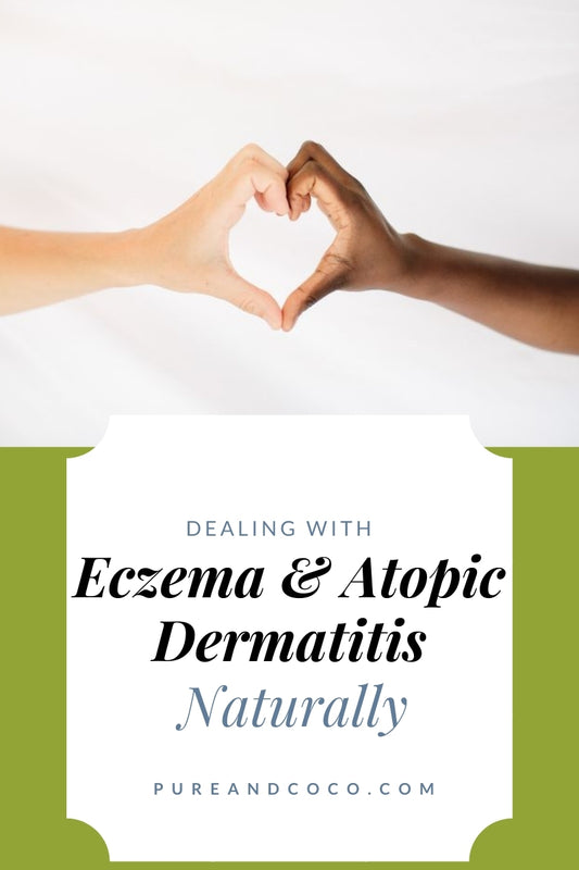 Dealing with Eczema and atopic dermatitis naturally blog by pure and coco