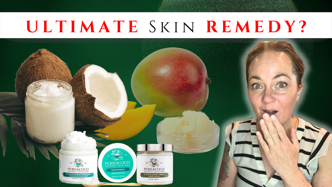Dry Skin Coconut Oil vs. Mango Butter_Which Heals Best_Pure and Coco