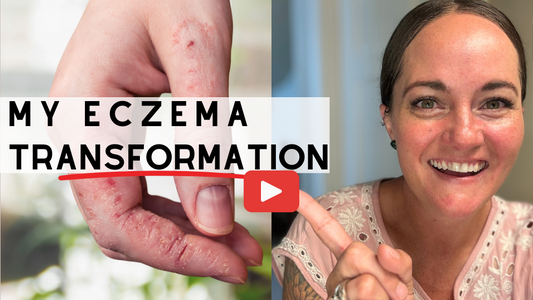 How I Turned My Dry Skin Routine Around #skincareover40