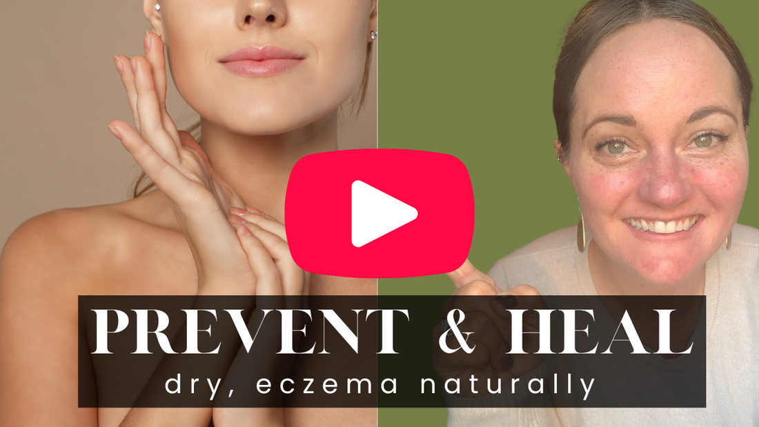 The best [EASY] tips for preventing & healing dry skin | Dull + eczema skin too by Pure & Coco